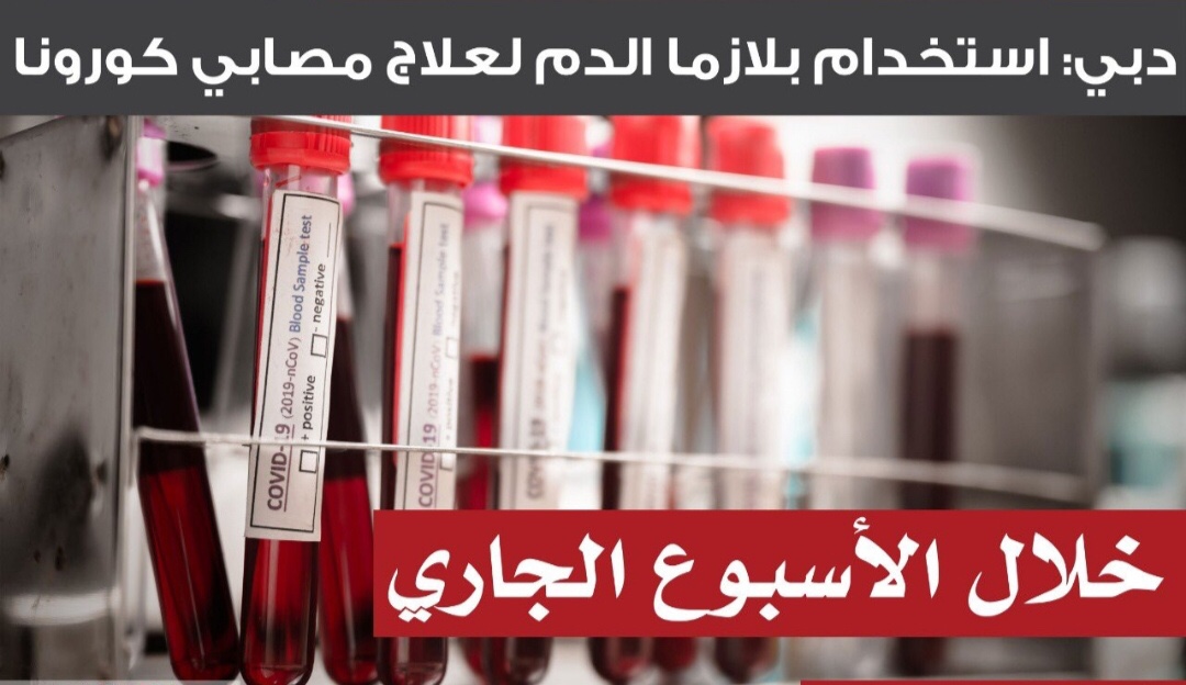 عربيا ً:الإمارات تشرع باستخدام بلازما الدم للمرضى المتعافين من كورونا و(1520) إصابة مؤكدة.. اليوم